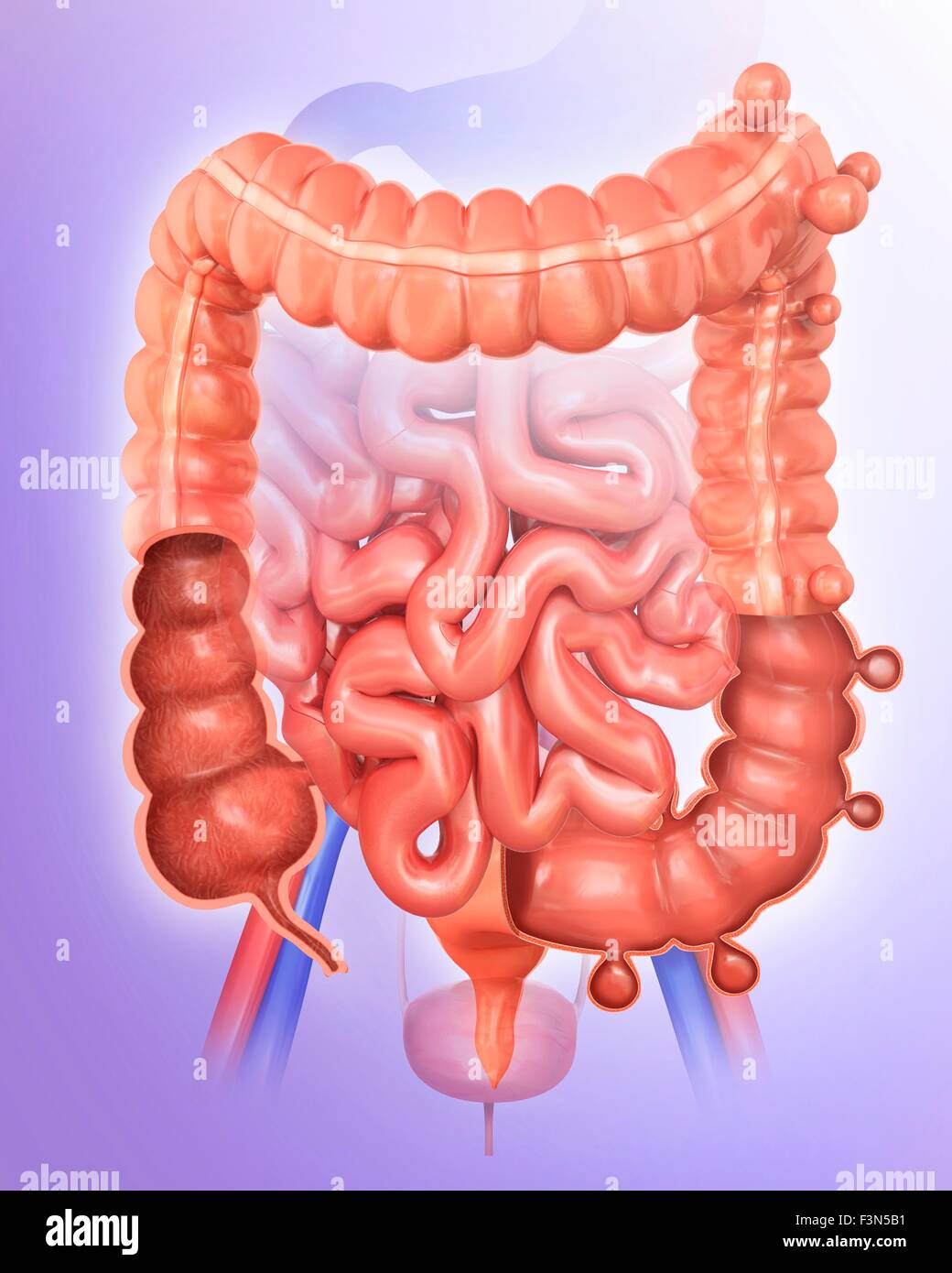 Diverticolosi, illustrazione Foto Stock