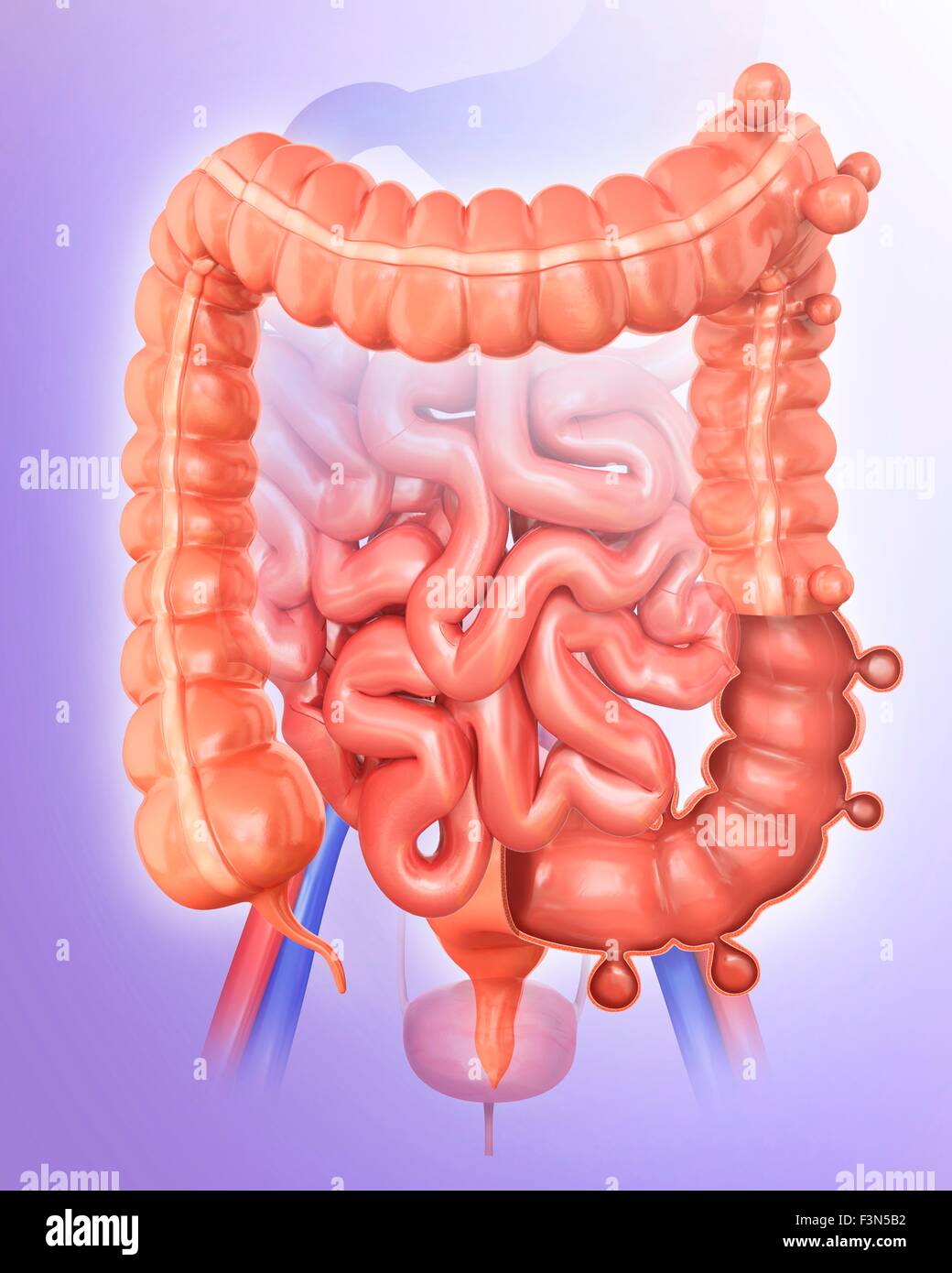 Diverticolosi, illustrazione Foto Stock