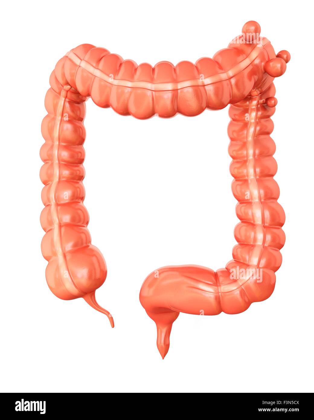 Diverticolosi, illustrazione Foto Stock