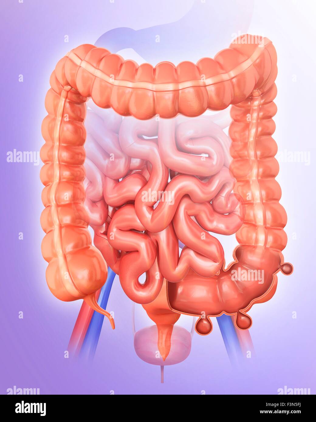 Diverticolosi, illustrazione Foto Stock