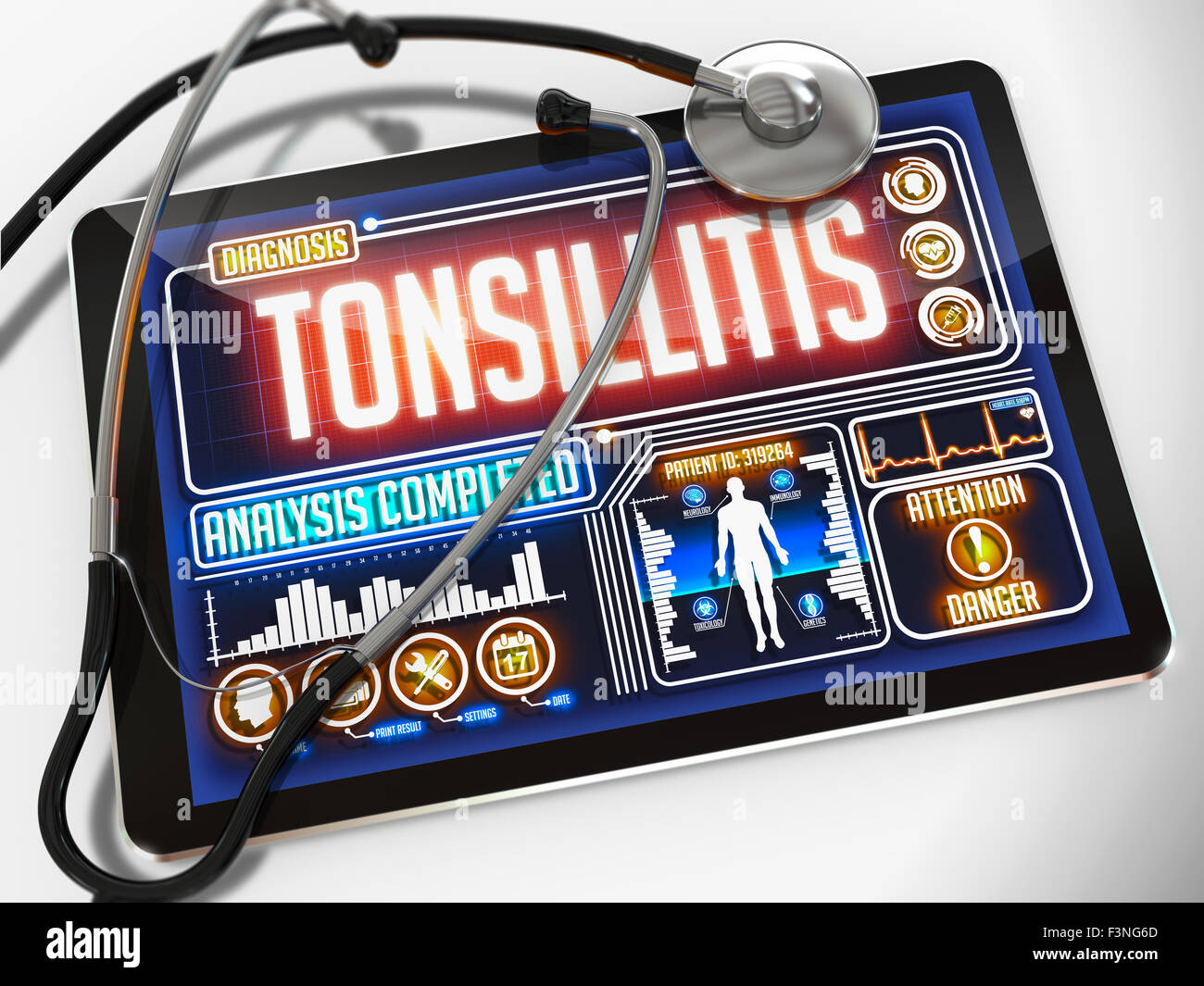 Tonsillite sul display del Medical Tablet. Foto Stock