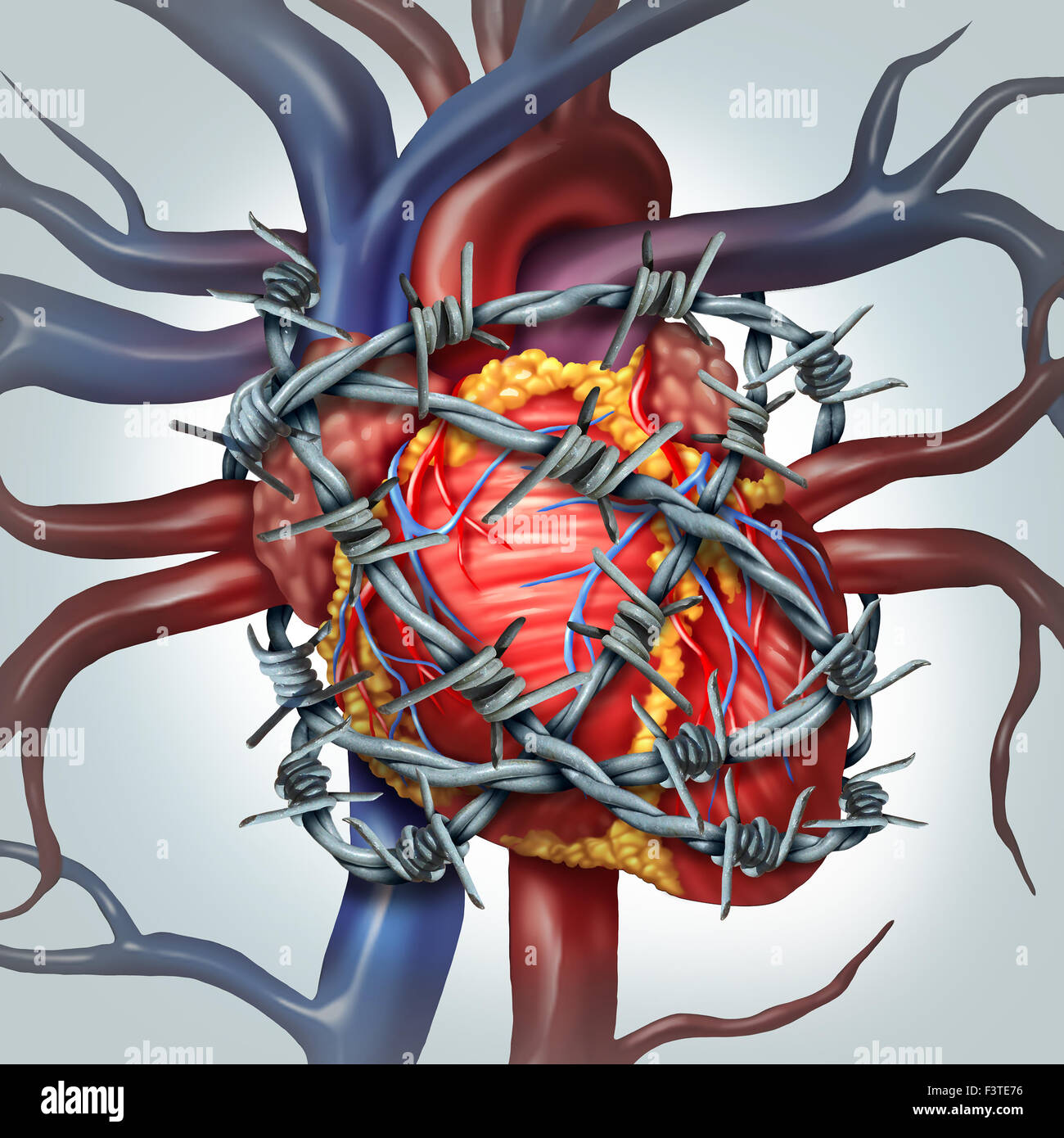 Il dolore del cuore cure mediche nozione come un umano organo cardiovascolare avvolto in forte filo spinato come una metafora per problemi coronarici e salute calo nella circolazione sanguigna. Foto Stock