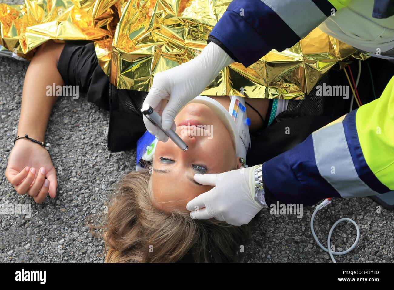 Un pupillare riflesso di luce di un paziente dopo un incidente Foto Stock