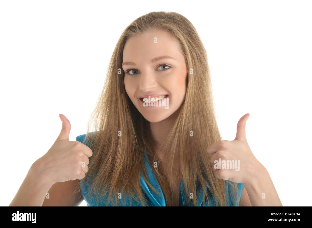 Donna con staffe sui denti Foto Stock