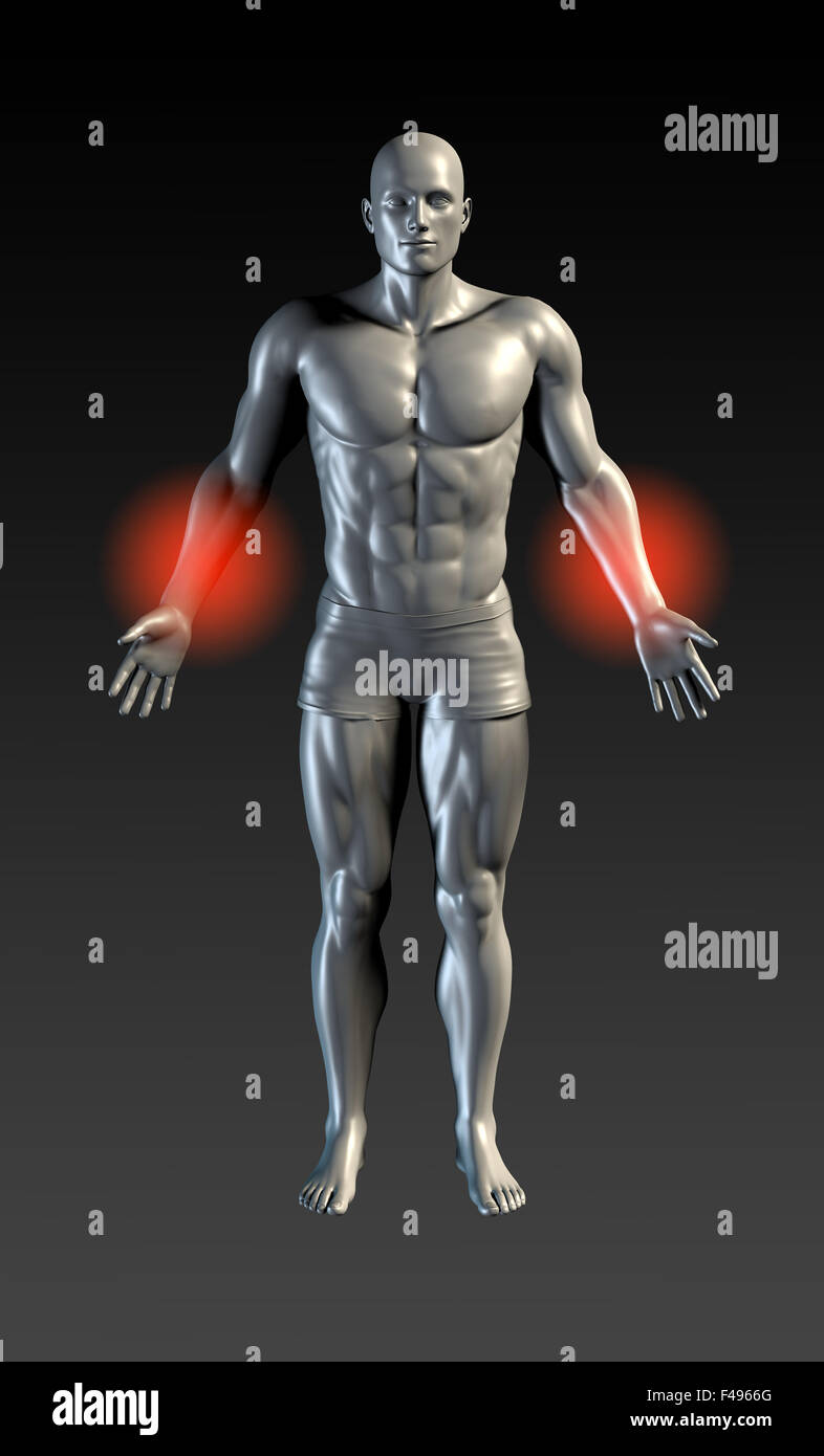 Avambraccio pregiudizio con il bagliore rosso sulla serie Area Foto Stock