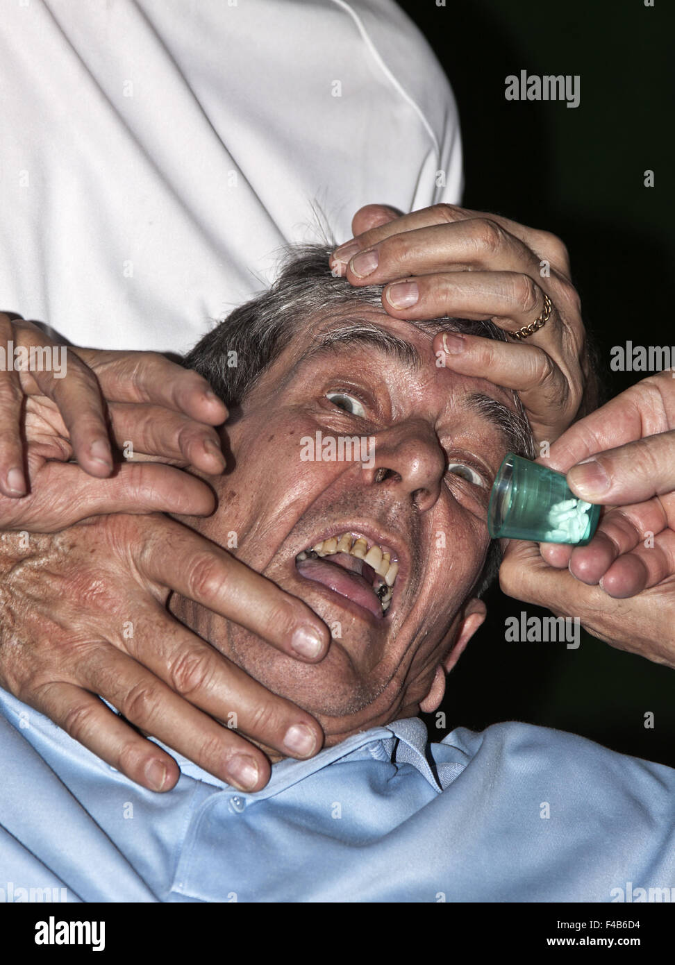 Medicazione forzata Foto Stock