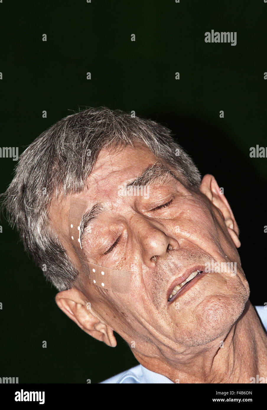 Vittima del pestaggio Foto Stock