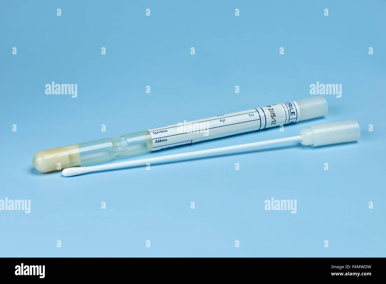 Il test diagnostico della cultura e tampone di supporto del tubo a sfondo blu. Foto Stock