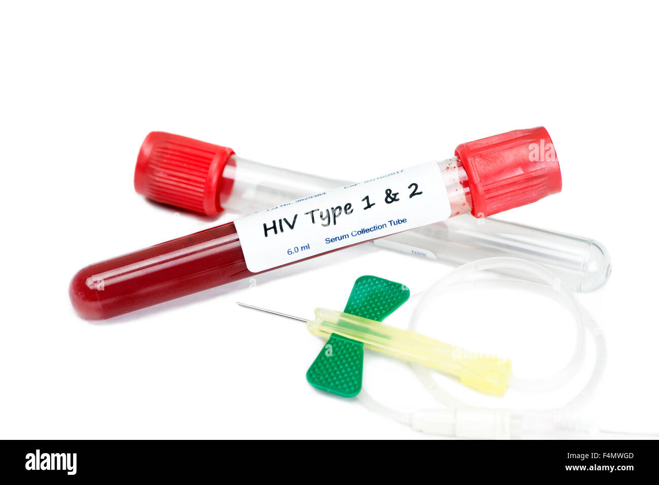 Virus HIV di tipo 1 e di tipo 2 test del sangue tubi di raccolta con farfalla il catetere e il supporto del tubo. Foto Stock