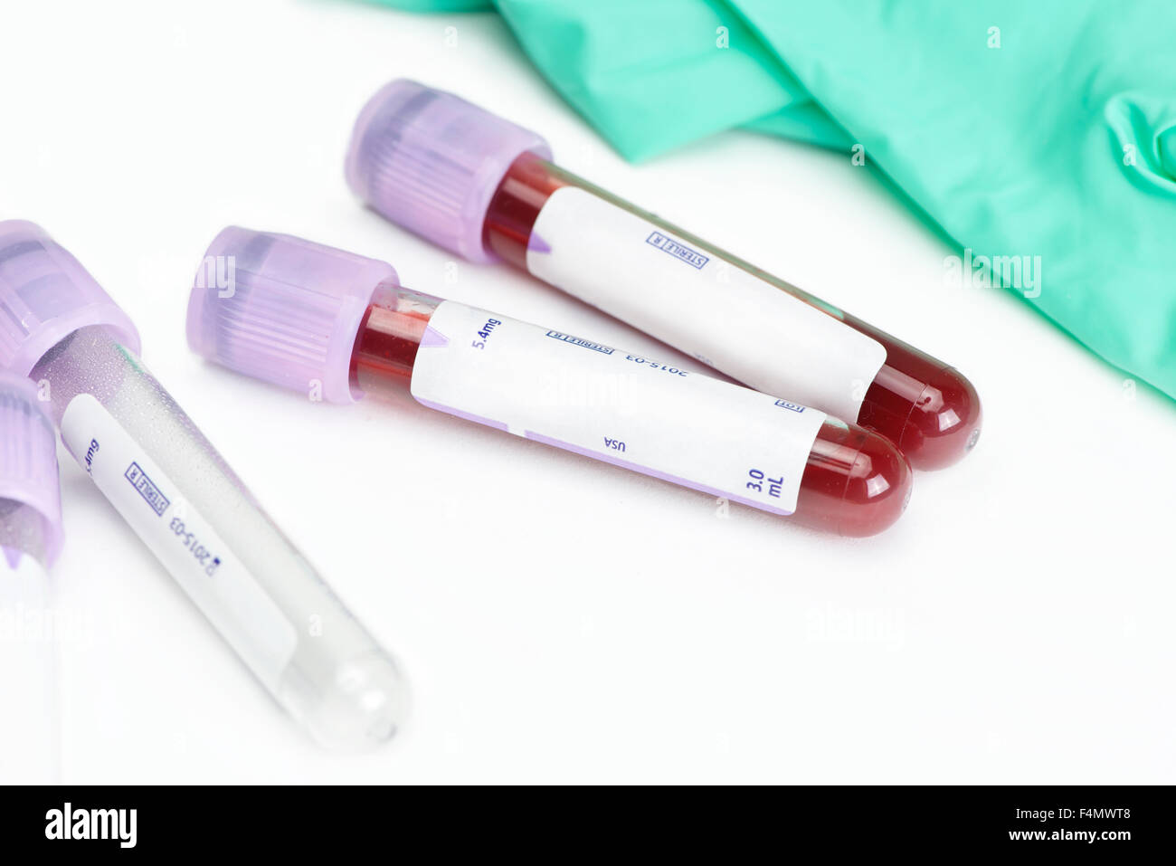 Top di lavanda per il prelievo del campione di sangue di tubi e guanti di nitrile. Foto Stock
