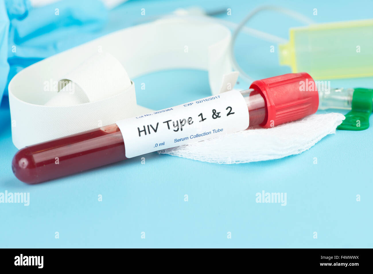 Virus HIV di tipo 1 e 2 per la raccolta di sangue con tubo di catetere a farfalla e banda. Foto Stock
