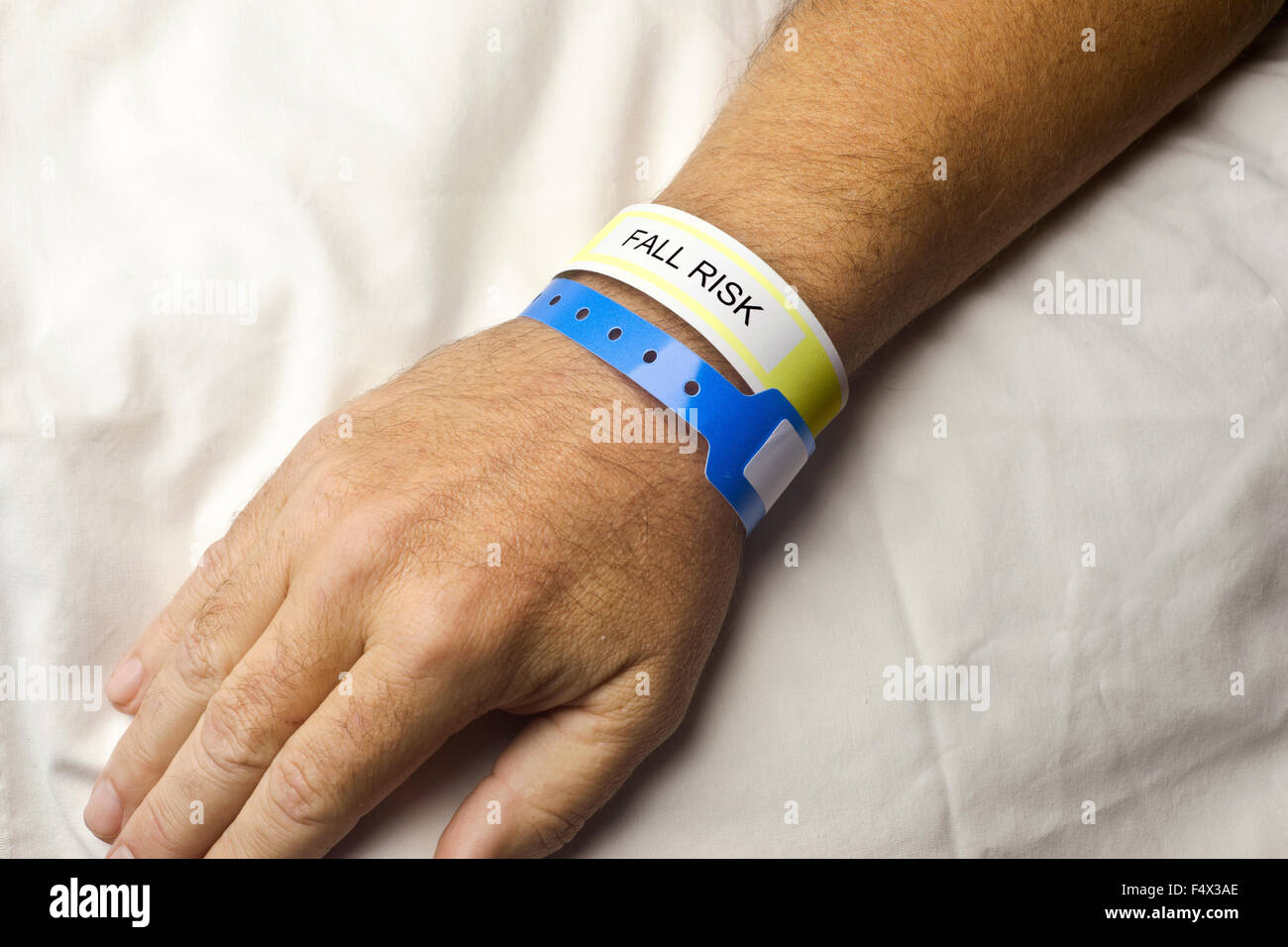 Paziente in ospedale con rischio di caduta bracciale sul polso. Foto Stock