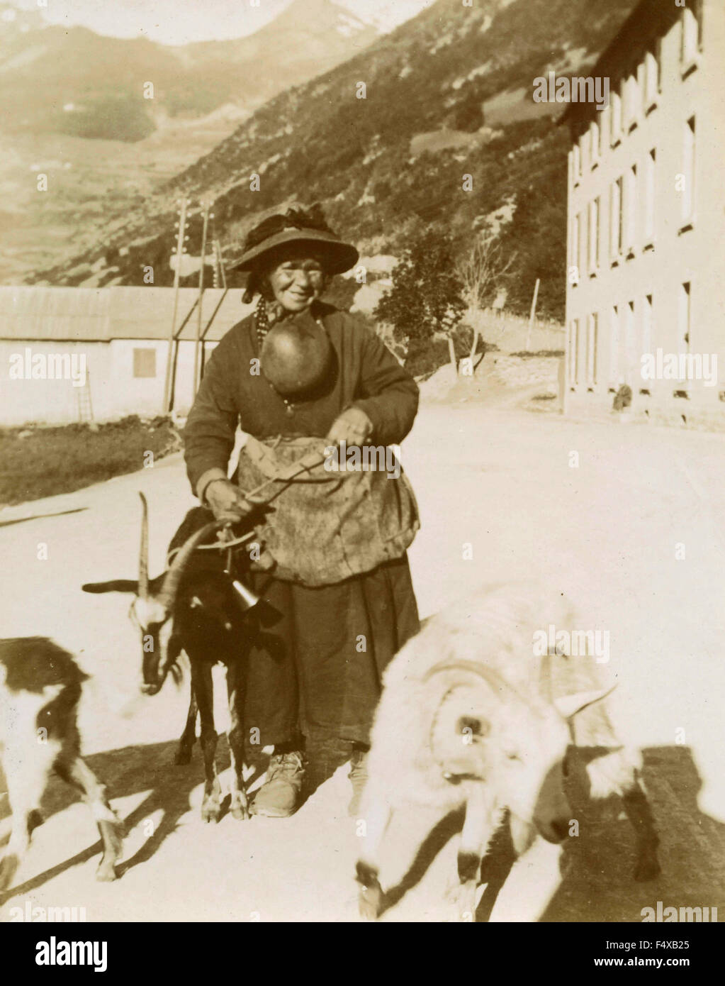 Una contadina con un enorme ciste Foto Stock