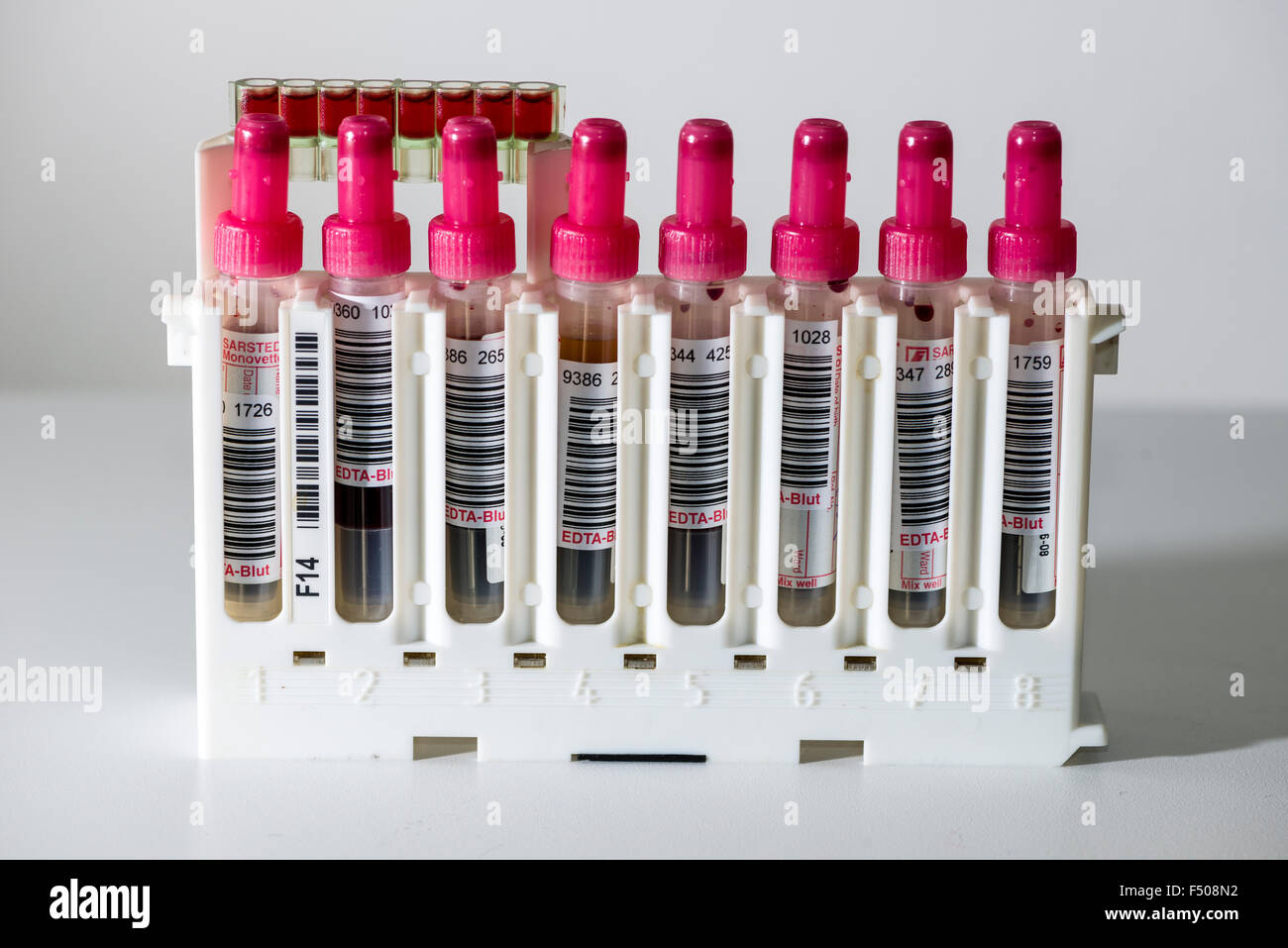 Molti tubi capillari, riempito con sangue per diagnosticare il tipo di sangue, sono ordinati in un rack di bianco Foto Stock