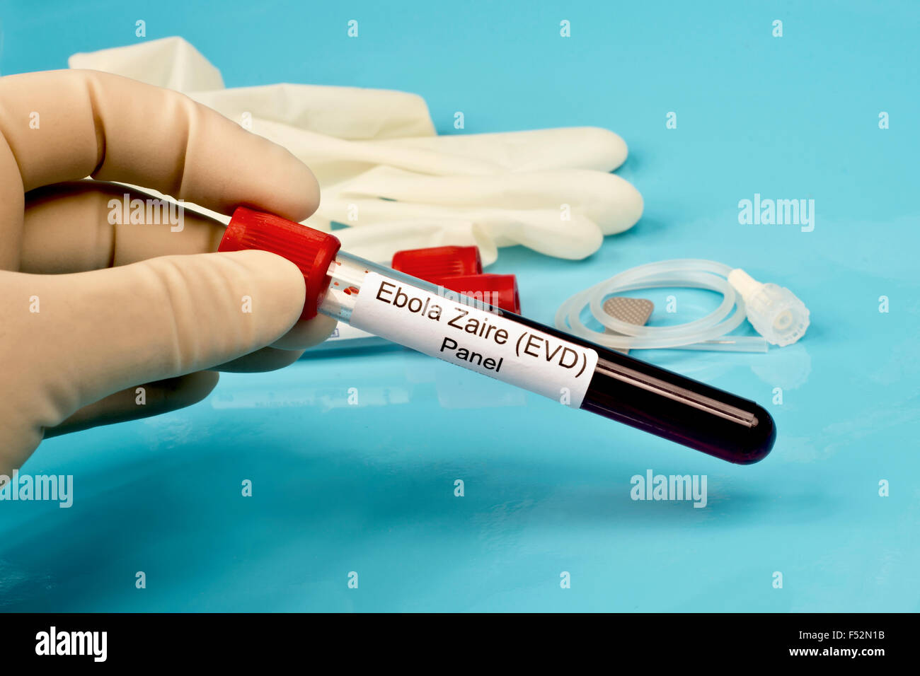 Il virus di Ebola nello Zaire il sangue del pannello di prova campione di laboratorio tenuto da tecnico di laboratorio. Foto Stock