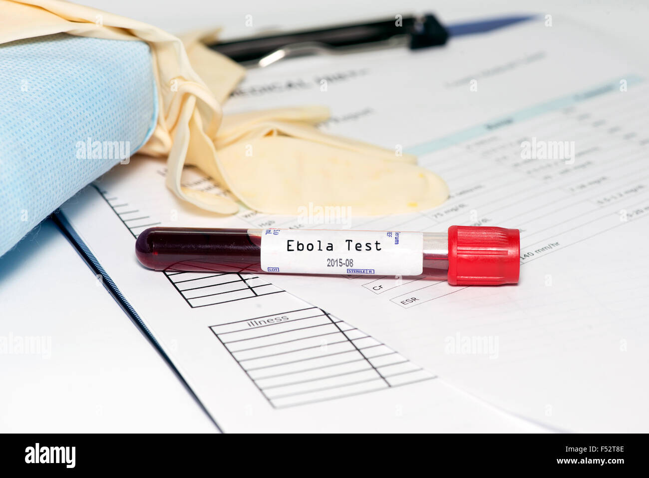 Provetta per la raccolta di sangue con il virus di Ebola etichetta di prova sul diagramma di medici con equipaggiamento di protezione personale. Foto Stock