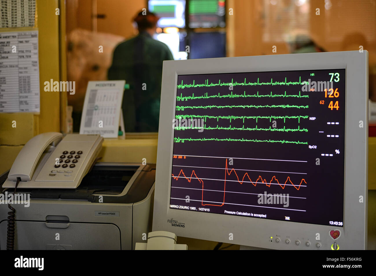 Il catetere di ablazione a laboratorio universitario Centro Clinico sorella della misericordia a Zagabria in Croazia Foto Stock