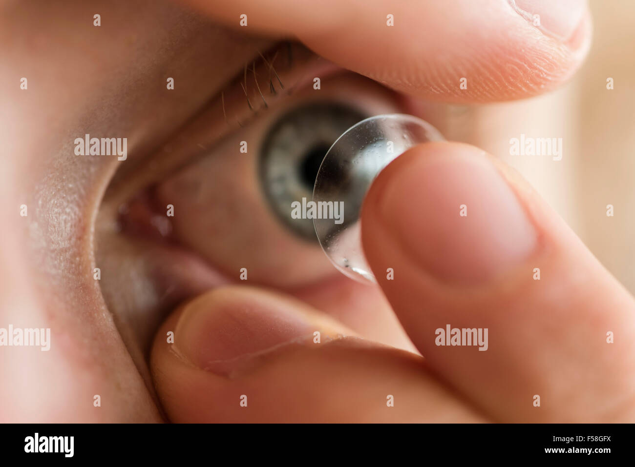 Un uomo è l'inserimento di una lente a contatto nel suo occhio sinistro. Foto Stock