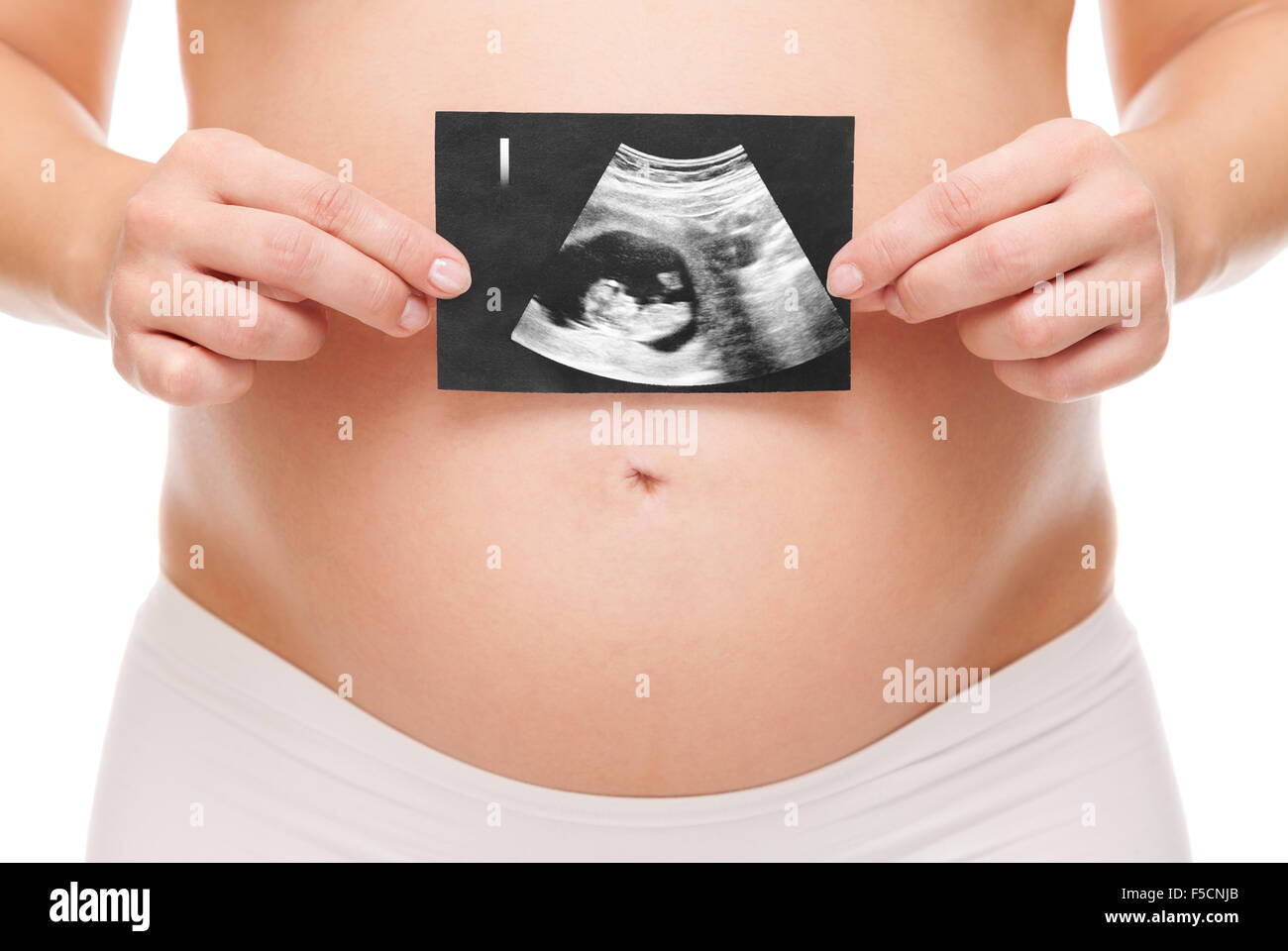 Donna incinta tenendo una scansione ad ultrasuoni del suo bambino Foto Stock