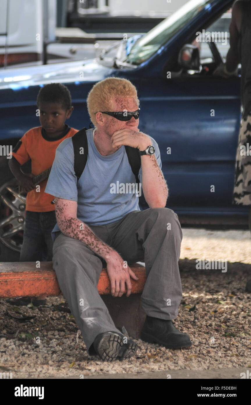 Un albino siede in Villa, nelle Isole del Pacifico Foto Stock