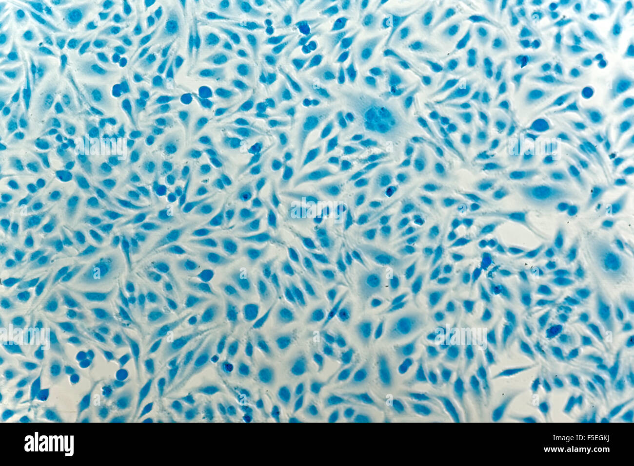 Cellule HeLa cellule di cancro della cervice, colorati con blu Coomassie, sotto microscopio. Foto Stock