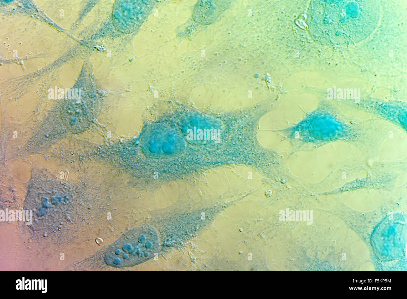 Cellule HeLa cellule di cancro della cervice, colorati con blu Coomassie, sotto differencial interference contrast microscopio. Foto Stock