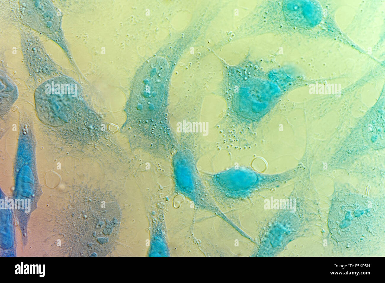 Cellule HeLa cellule di cancro della cervice, colorati con blu Coomassie, sotto differencial interference contrast microscopio. Foto Stock