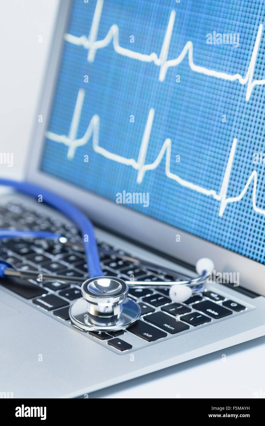 Cardiologia moderna. Stetoscopio acustico su un computer portatile che consente di visualizzare un tracciato ECG Foto Stock