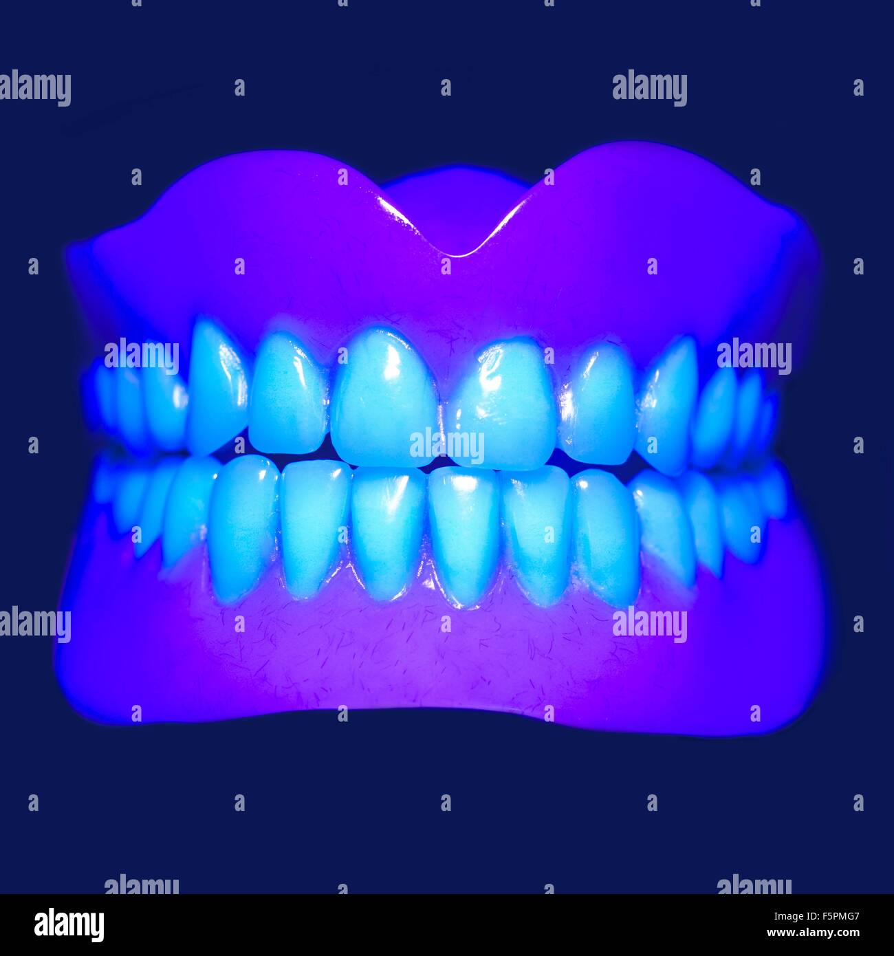 Modello di denti in UV (ultravioletti), vicino. Foto Stock