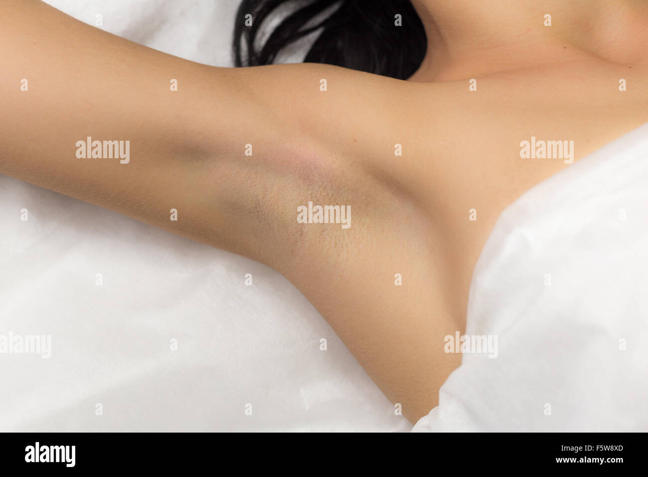 Underarm client ragazza dopo la depilazione laser Foto Stock