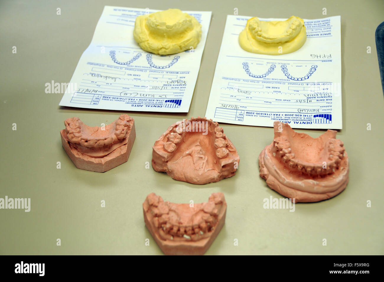 Un ortodontista è un tipo di dentista specializzato di raddrizzare i denti storti. Denti di stampi e gli schemi per i pazienti. Foto Stock