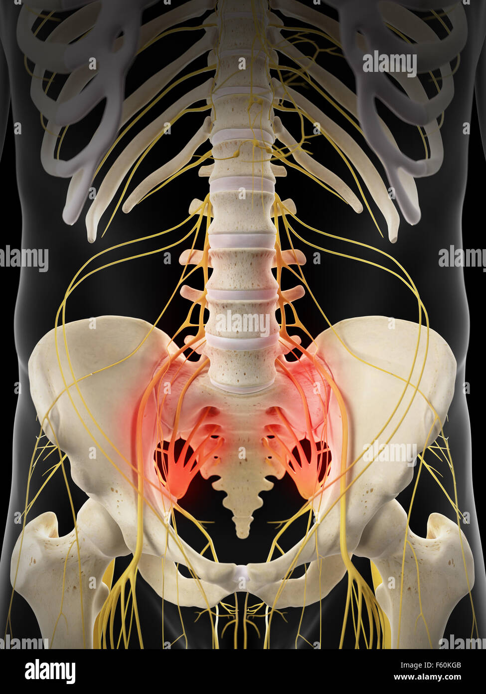 Dal punto di vista medico illustrazione accurata - dolorosa nervi sacrale Foto Stock