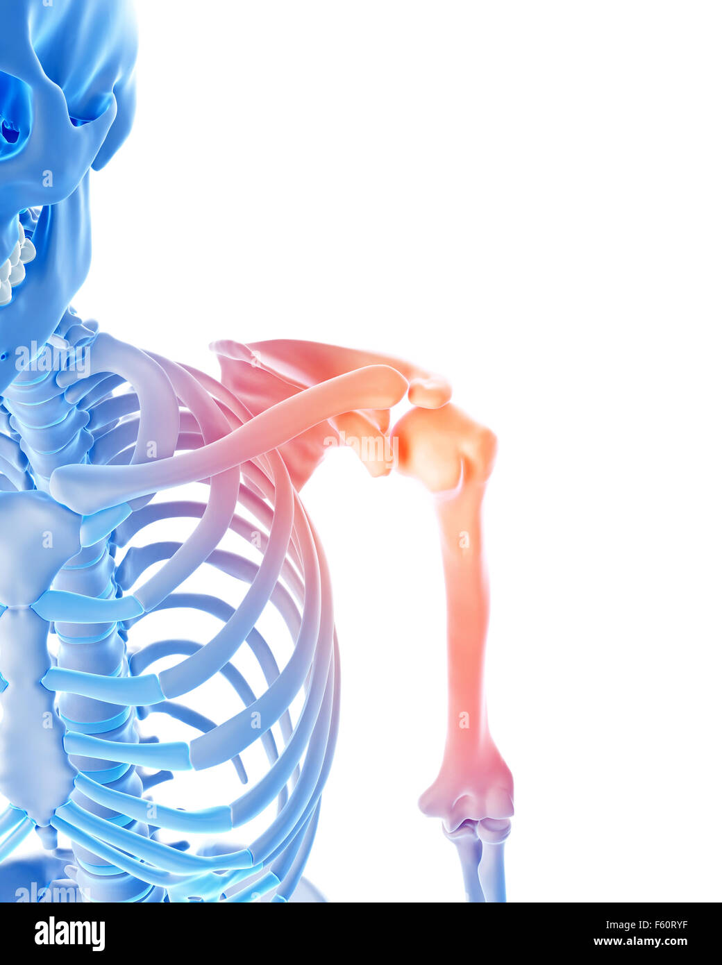 Medical 3d illustrazione di una spalla dolorosa Foto Stock