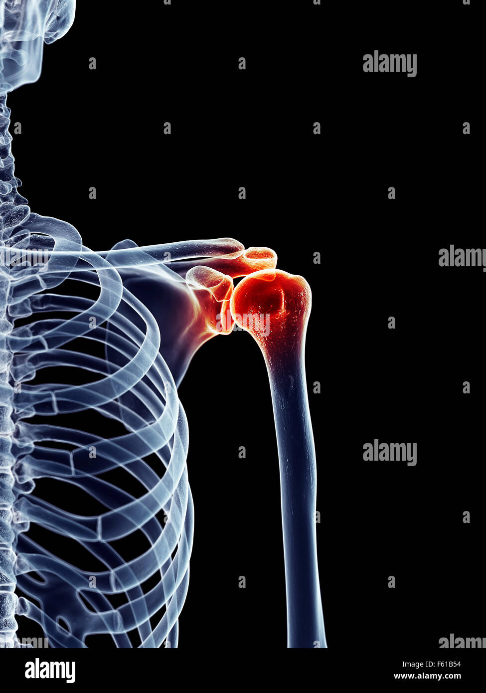 Dal punto di vista medico illustrazione accurata - spalla dolorosa Foto Stock