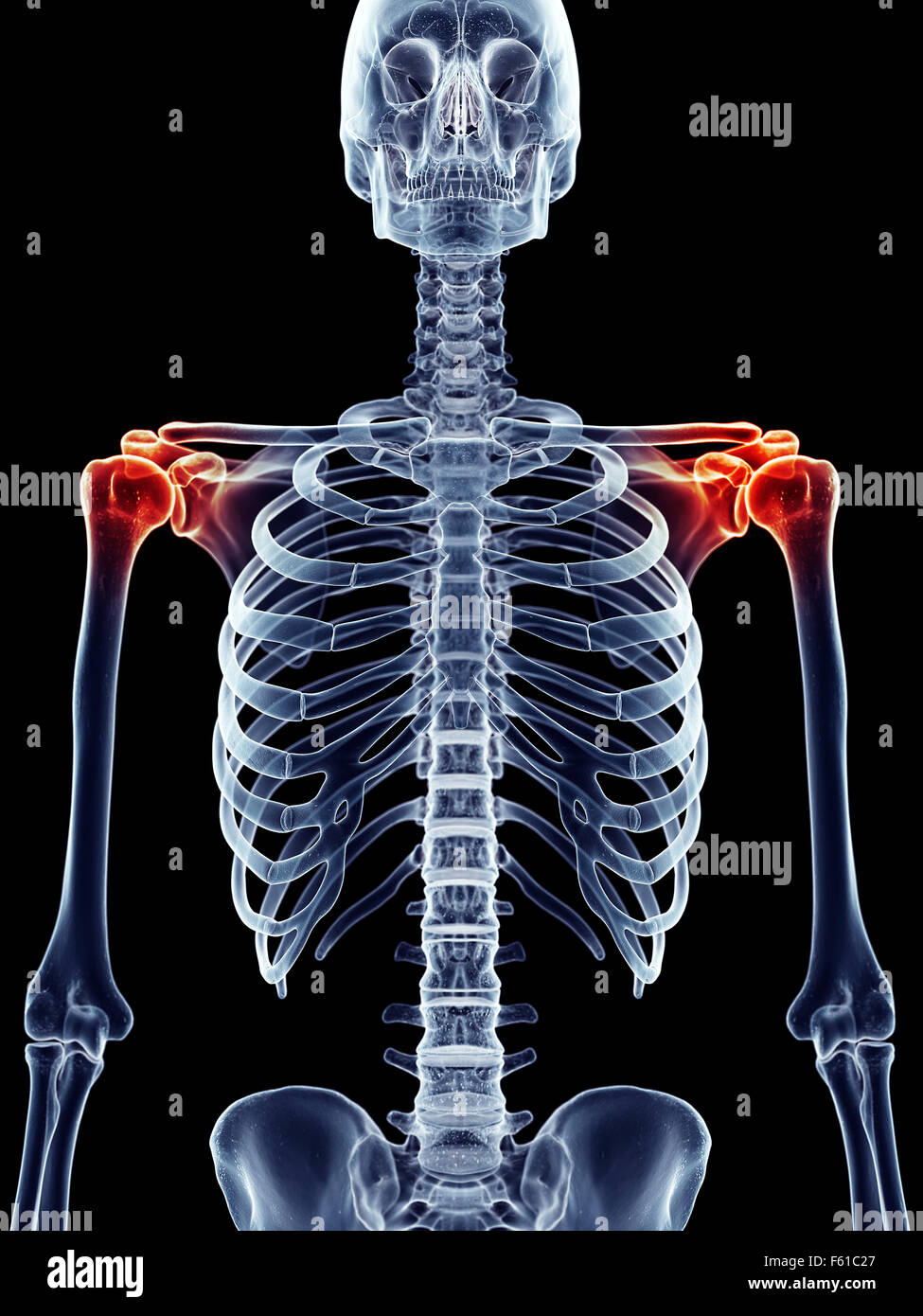 Dal punto di vista medico illustrazione accurata - spalla dolorosa Foto Stock
