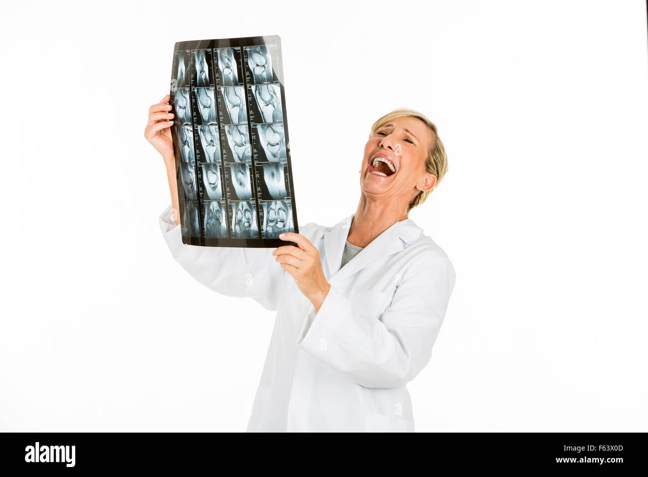 Medico donna che guarda la paziente a raggi x Foto Stock