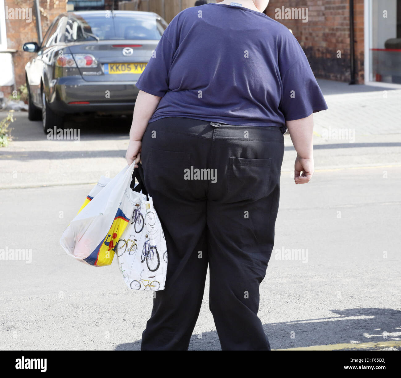 Donna obesa. Foto Stock