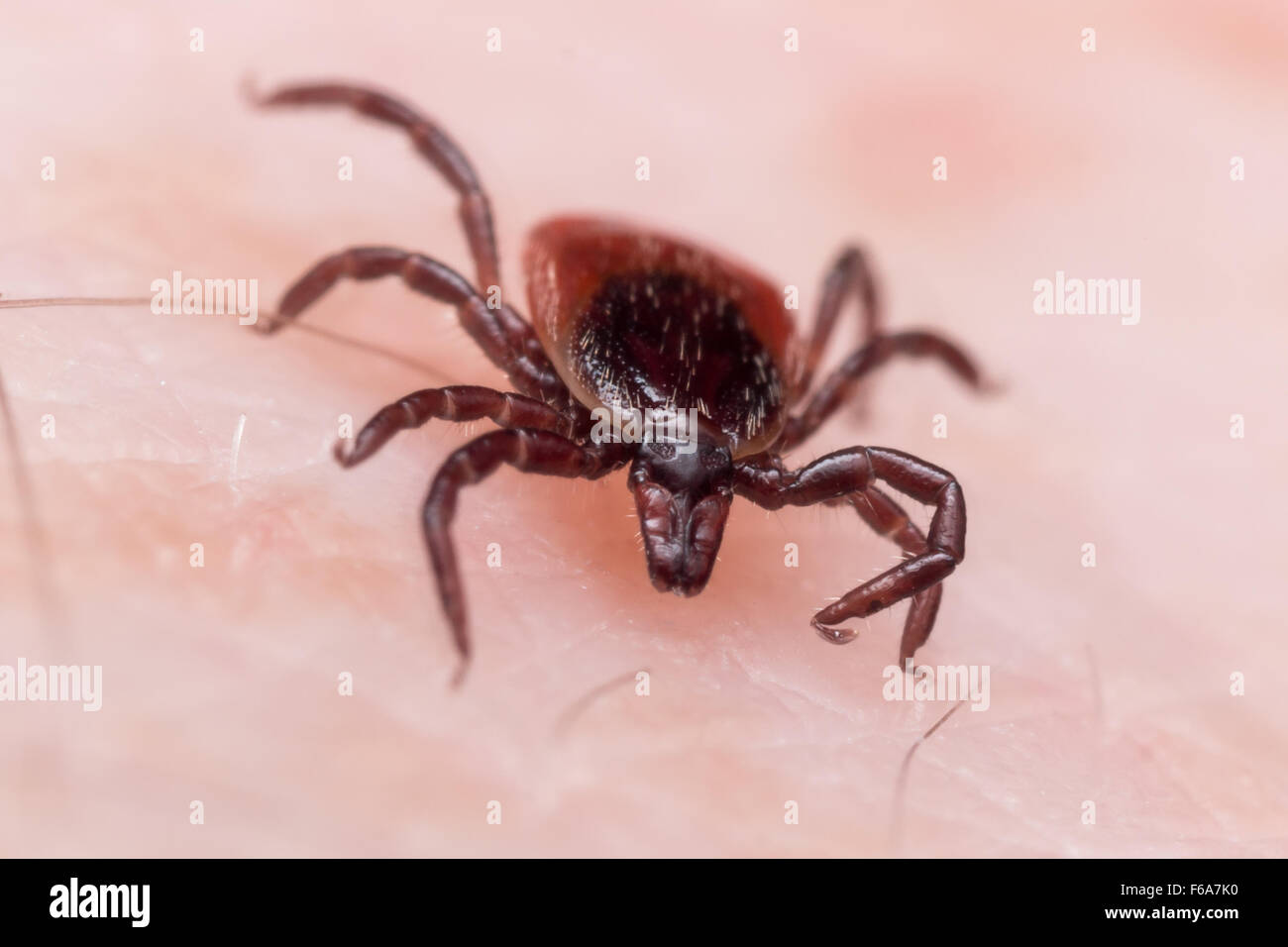 Extreme close up foto di femmina adulta deer tick strisciando sulla pelle bianca Foto Stock