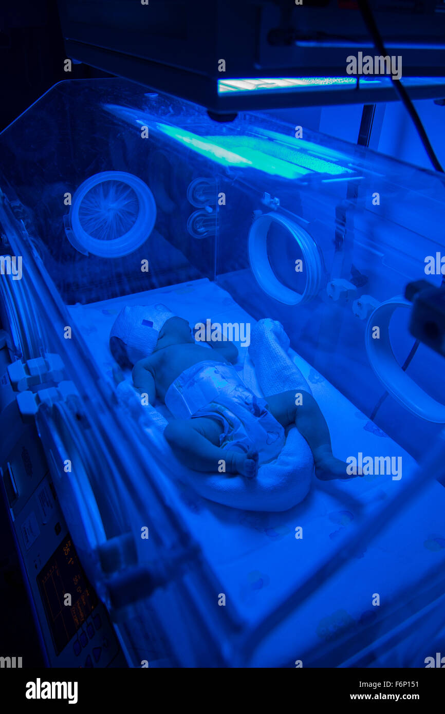 Neonato aventi raggi UVB trattamento di fototerapia per ittero in ospedale Foto Stock