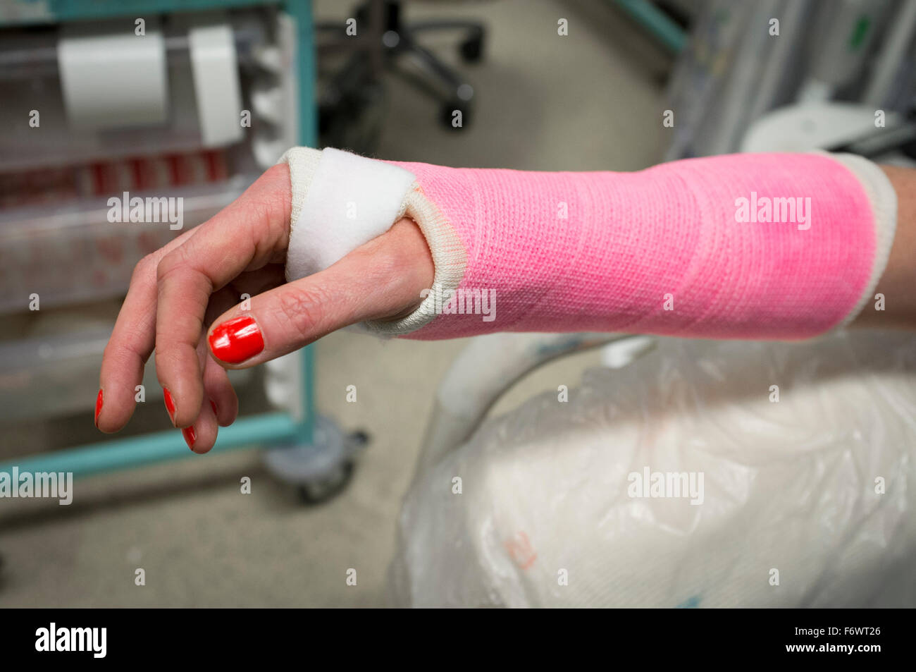 Intonacato di fresco lady del polso in un rosa calco in gesso in un ospedale di incidenti e dipartimento di emergenza. Foto Stock