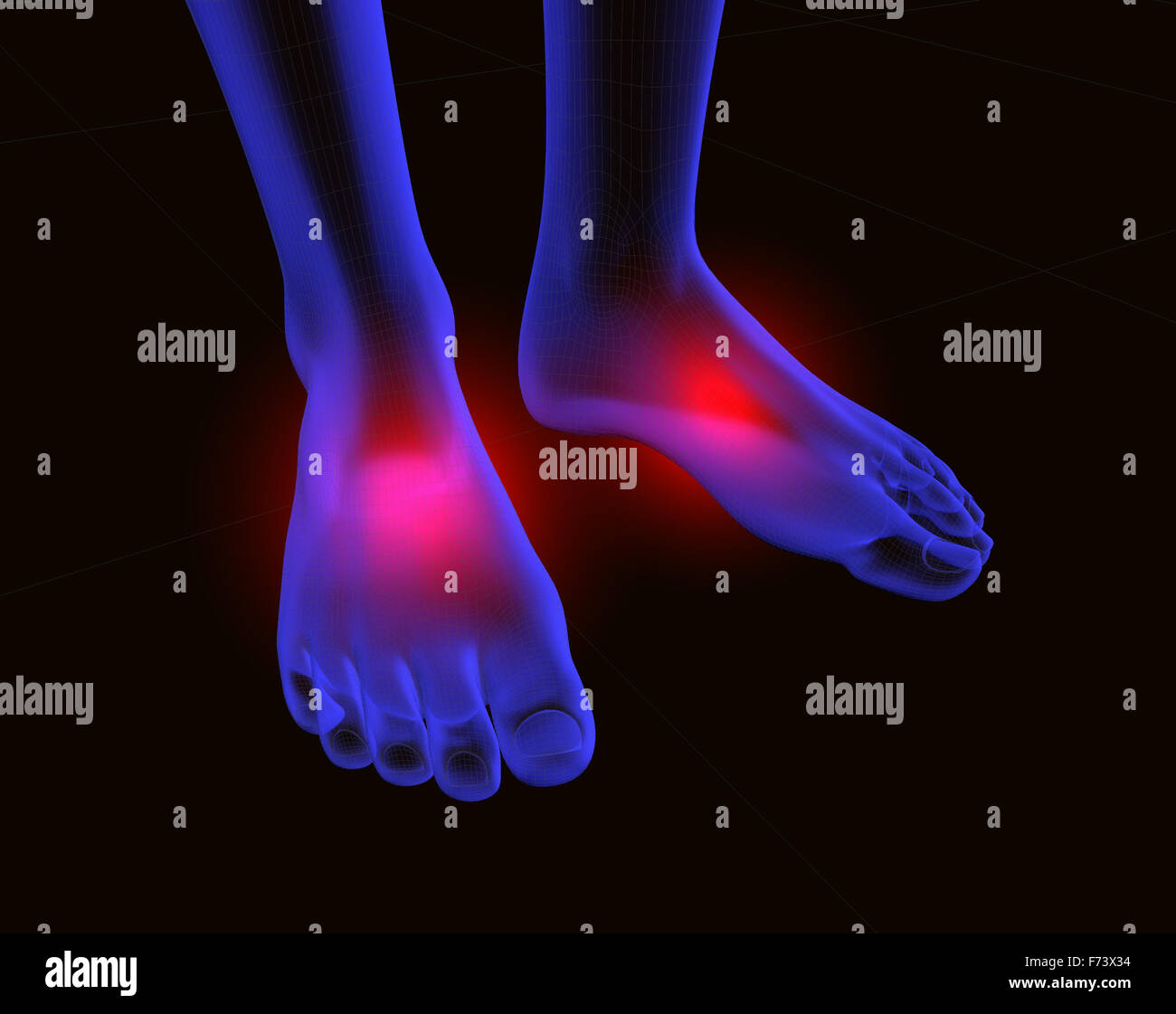 Piedi il concetto di dolore Foto Stock