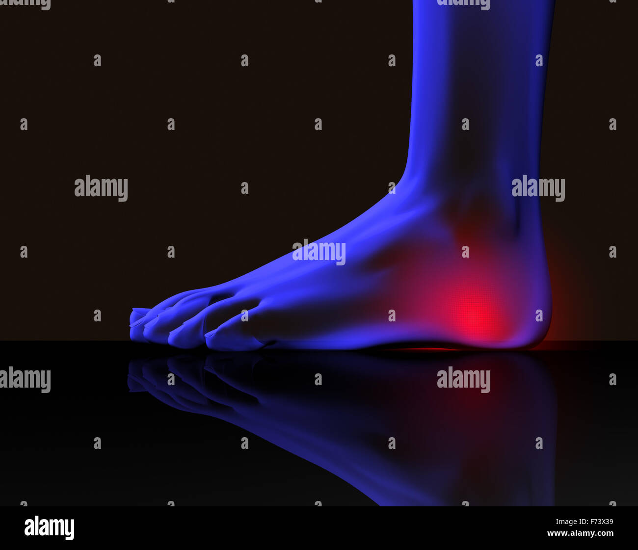 Piedi il concetto di dolore Foto Stock