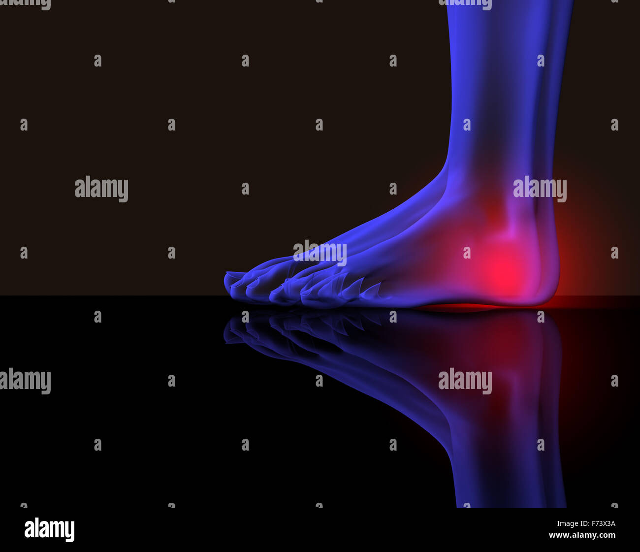 Piedi il concetto di dolore Foto Stock