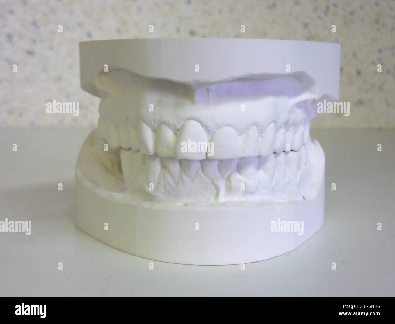 In gesso bianco bocca Foto Stock