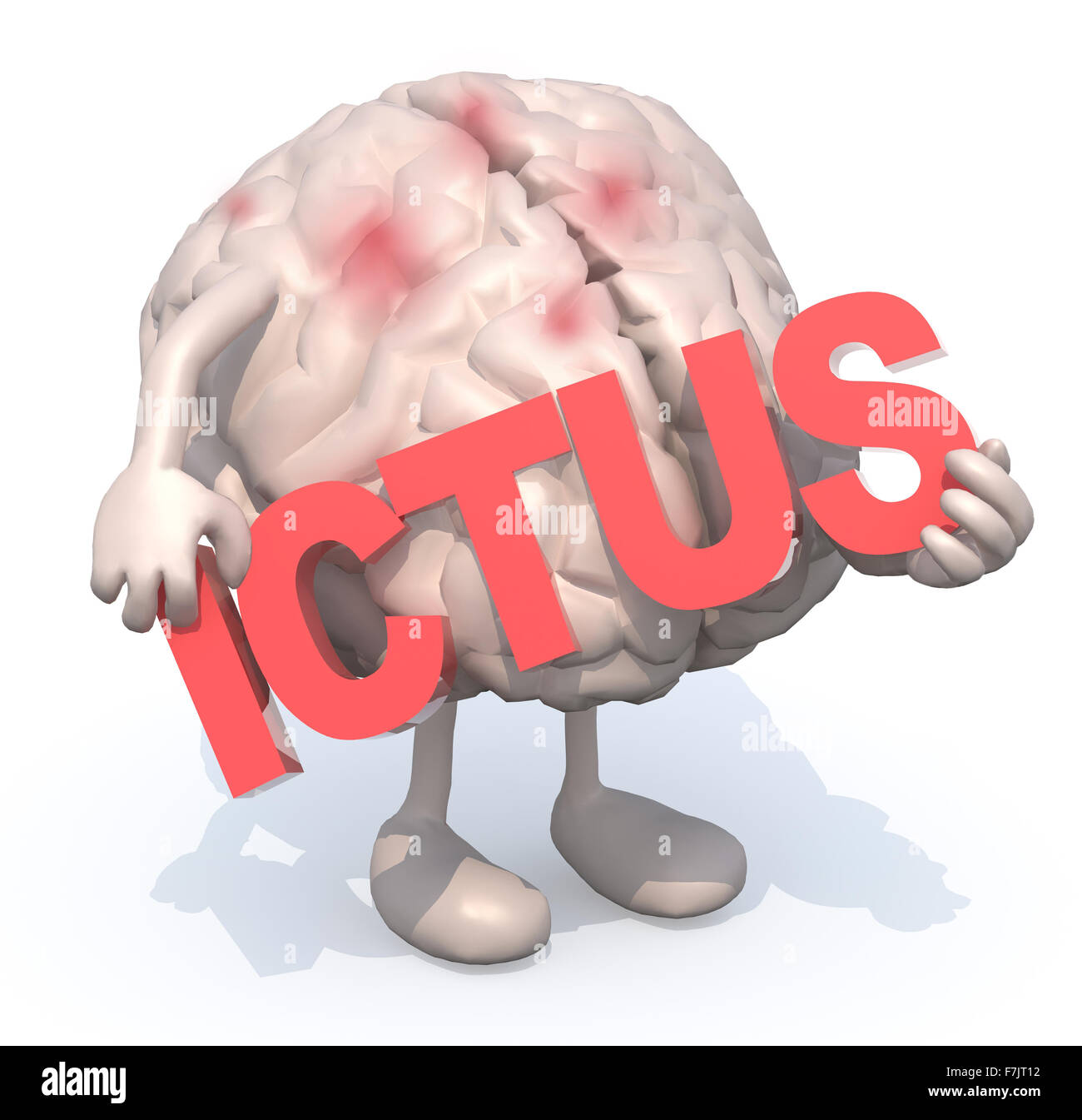 Cervello umano con arti che abbraccia una parola 'ictus', 3d illustrazione Foto Stock