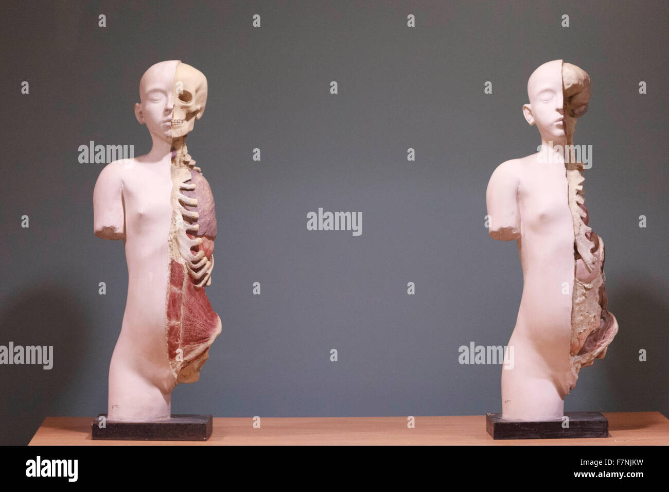 Edinburgh, Regno Unito. 2 dicembre. Anatomia mostra evidenzia del corpo bellezze dentro e fuori. Università di Edimburgo visualizzare un notevole highlinting presentano complicazioni del polmone umano. Pak@ Mera/Alamy Live News. Foto Stock