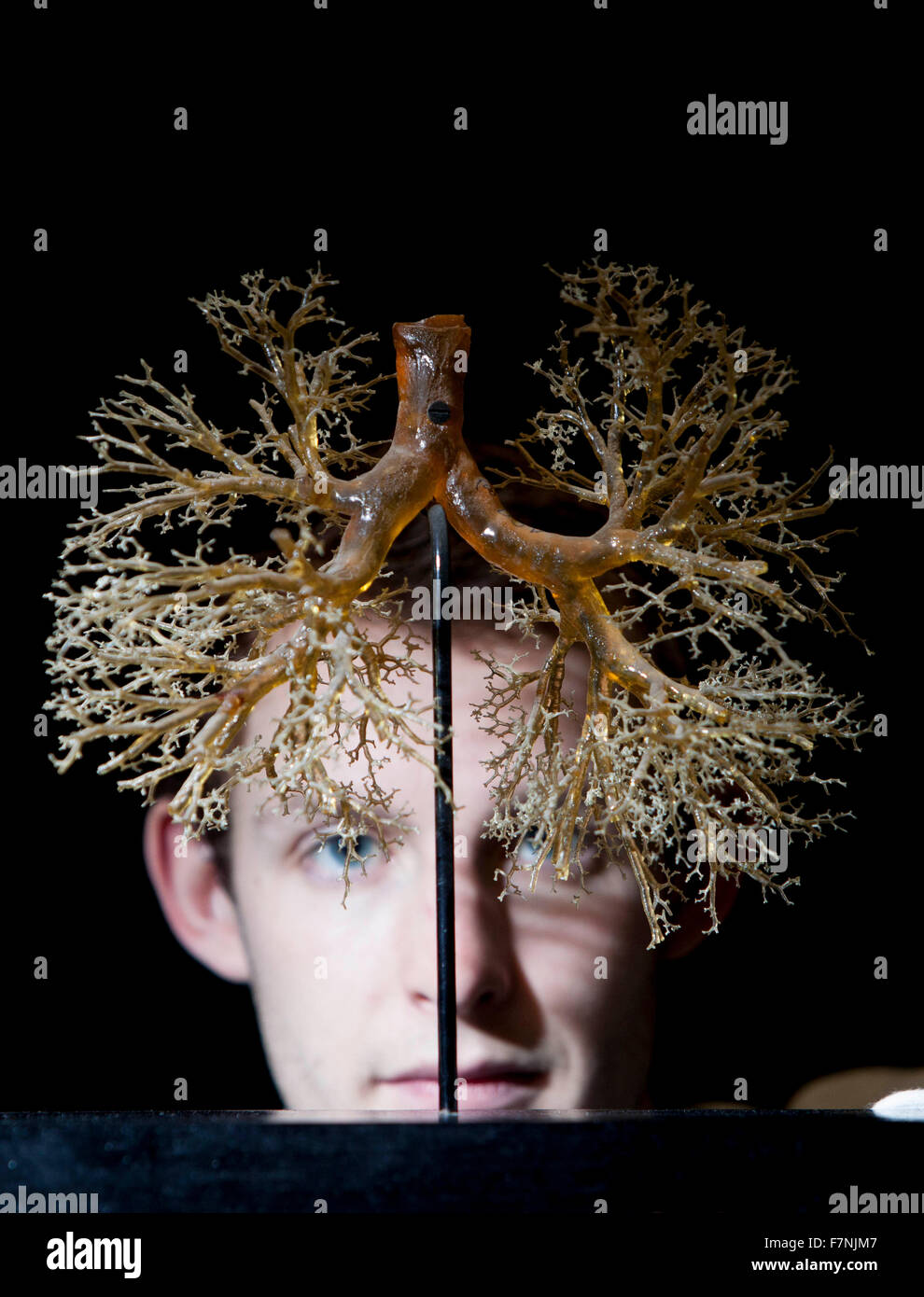 Edinburgh, Regno Unito. 2 dicembre. Anatomia mostra evidenzia del corpo bellezze dentro e fuori. Università di Edimburgo visualizzare un notevole highlinting presentano complicazioni del polmone umano. Foto di Doug Stevens curatore della mostra. Pak@ Mera/Alamy Live News. Foto Stock
