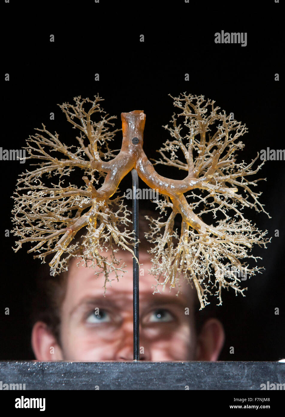 Edinburgh, Regno Unito. 2 dicembre. Anatomia mostra evidenzia del corpo bellezze dentro e fuori. Università di Edimburgo visualizzare un notevole highlinting presentano complicazioni del polmone umano. Pak@ Mera/Alamy Live News. Foto Stock