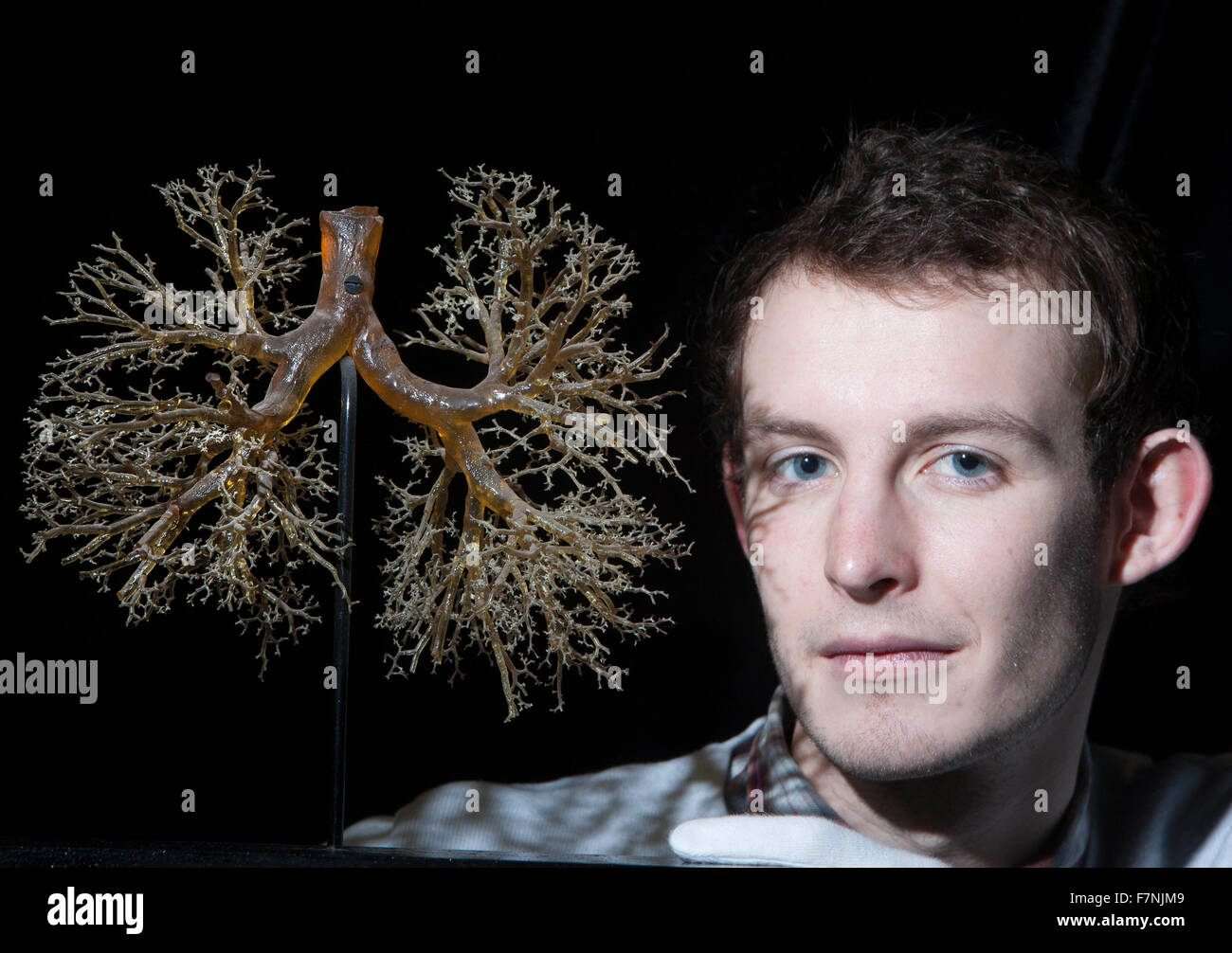 Edinburgh, Regno Unito. 2 dicembre. Anatomia mostra evidenzia del corpo bellezze dentro e fuori. Università di Edimburgo visualizzare un notevole highlinting presentano complicazioni del polmone umano. Foto di Doug Stevens curatore della mostra. Pak@ Mera/Alamy Live News. Foto Stock