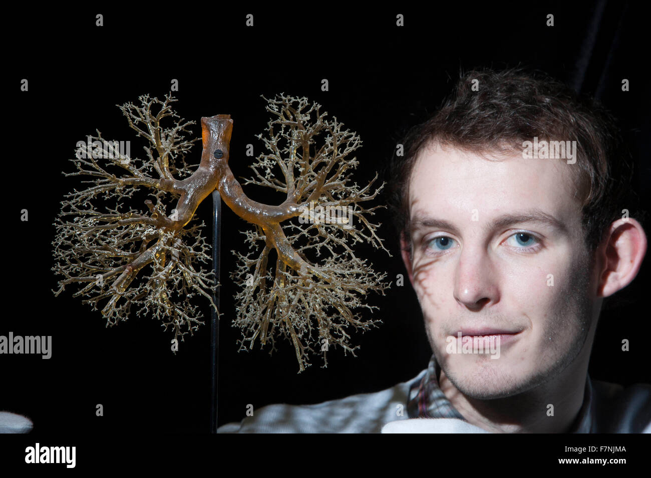 Edinburgh, Regno Unito. 2 dicembre. Anatomia mostra evidenzia del corpo bellezze dentro e fuori. Università di Edimburgo visualizzare un notevole highlinting presentano complicazioni del polmone umano. Foto di Doug Stevens curatore della mostra. Pak@ Mera/Alamy Live News. Foto Stock